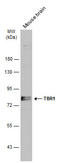 T-Box, Brain 1 antibody, GTX133228, GeneTex, Western Blot image 