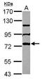 U3 small nucleolar ribonucleoprotein protein MPP10 antibody, GTX112221, GeneTex, Western Blot image 