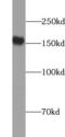 Unc-51 Like Autophagy Activating Kinase 1 antibody, FNab09251, FineTest, Western Blot image 