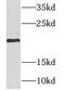 NADH:Ubiquinone Oxidoreductase Complex Assembly Factor 4 antibody, FNab05616, FineTest, Western Blot image 