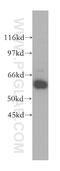 Prolyl 4-hydroxylase subunit alpha-2 antibody, 13759-1-AP, Proteintech Group, Western Blot image 