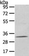 Uridine Phosphorylase 2 antibody, PA5-50894, Invitrogen Antibodies, Western Blot image 