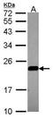 Caveolin 2 antibody, TA308863, Origene, Western Blot image 