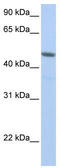 Nuclear RNA Export Factor 3 antibody, TA343910, Origene, Western Blot image 