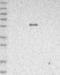 Leiomodin 1 antibody, NBP1-89398, Novus Biologicals, Western Blot image 