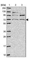 Lymphocyte Antigen 9 antibody, NBP2-30776, Novus Biologicals, Western Blot image 
