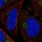 Patched 1 antibody, NBP2-57927, Novus Biologicals, Immunocytochemistry image 