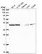 Proteasome 26S Subunit, ATPase 2 antibody, HPA049621, Atlas Antibodies, Western Blot image 