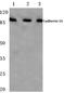 Cadherin-16 antibody, AP06796PU-N, Origene, Western Blot image 