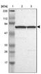 Baculoviral IAP Repeat Containing 2 antibody, NBP1-90133, Novus Biologicals, Western Blot image 