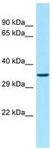 Olfactory Receptor Family 51 Subfamily V Member 1 antibody, TA332305, Origene, Western Blot image 