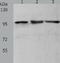 Minichromosome Maintenance Complex Component 4 antibody, TA321984, Origene, Western Blot image 