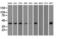 Nucleoredoxin Like 2 antibody, GTX83972, GeneTex, Western Blot image 