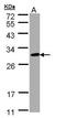 Cysteine-rich hydrophobic domain 2 protein antibody, GTX109124, GeneTex, Western Blot image 