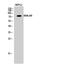 Solute Carrier Family 25 Member 12 antibody, GTX34202, GeneTex, Immunohistochemistry paraffin image 