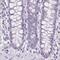 p24 antibody, PA5-57726, Invitrogen Antibodies, Immunohistochemistry frozen image 