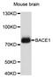 Beta-Secretase 1 antibody, STJ29309, St John