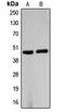 Beta-1,4-Galactosyltransferase 5 antibody, LS-C353151, Lifespan Biosciences, Western Blot image 