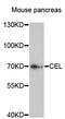 Carboxyl Ester Lipase antibody, A13011, ABclonal Technology, Western Blot image 