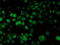 Histidyl-TRNA Synthetase 2, Mitochondrial antibody, LS-C173457, Lifespan Biosciences, Immunofluorescence image 