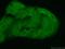 Interleukin 1 Receptor Associated Kinase 1 antibody, 10478-2-AP, Proteintech Group, Immunofluorescence image 