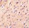 Cerebellin 1 Precursor antibody, A09176-3, Boster Biological Technology, Immunohistochemistry paraffin image 