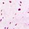 PELP1 antibody, LS-C668638, Lifespan Biosciences, Immunohistochemistry paraffin image 