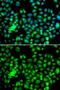 Heat Shock Protein Family B (Small) Member 8 antibody, GTX64490, GeneTex, Immunocytochemistry image 