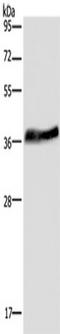 Lumican antibody, TA350145, Origene, Western Blot image 