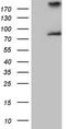 Arachidonate 5-lipoxygenase antibody, TA807021, Origene, Western Blot image 