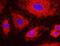 NOP56 Ribonucleoprotein antibody, NBP1-46848, Novus Biologicals, Proximity Ligation Assay image 