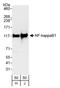 Nuclear Factor Kappa B Subunit 1 antibody, A301-820A, Bethyl Labs, Western Blot image 