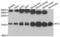 6-pyruvoyl tetrahydrobiopterin synthase antibody, LS-C334626, Lifespan Biosciences, Western Blot image 