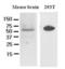 Dishevelled Binding Antagonist Of Beta Catenin 3 antibody, GTX50032, GeneTex, Western Blot image 