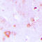Aldolase, Fructose-Bisphosphate C antibody, LS-C354525, Lifespan Biosciences, Immunohistochemistry paraffin image 
