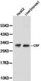 C-Reactive Protein antibody, LS-C192667, Lifespan Biosciences, Western Blot image 