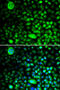 Voltage-dependent calcium channel gamma-2 subunit antibody, abx005016, Abbexa, Western Blot image 