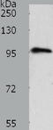 Transient Receptor Potential Cation Channel Subfamily C Member 3 antibody, TA321569, Origene, Western Blot image 