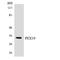 Peroxisomal biogenesis factor 19 antibody, LS-C200483, Lifespan Biosciences, Western Blot image 