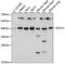 Galactokinase antibody, LS-C750243, Lifespan Biosciences, Western Blot image 