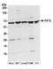 Eukaryotic translation initiation factor 3 subunit L antibody, A304-754A, Bethyl Labs, Western Blot image 