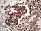 Kelch Like ECH Associated Protein 1 antibody, M00514, Boster Biological Technology, Immunohistochemistry paraffin image 