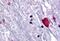 Bombesin Receptor Subtype 3 antibody, NBP1-02397, Novus Biologicals, Immunohistochemistry paraffin image 