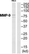 Matrix Metallopeptidase 9 antibody, TA312179, Origene, Western Blot image 