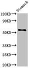 SWI/SNF-related matrix-associated actin-dependent regulator of chromatin subfamily D member 3 antibody, orb401048, Biorbyt, Western Blot image 