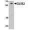 Zinc finger protein GLIS2 antibody, TA349140, Origene, Western Blot image 