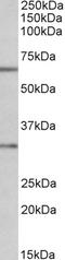 Caspase 3 antibody, EB07286, Everest Biotech, Western Blot image 