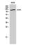 cGMP-dependent protein kinase 2 antibody, PA5-50931, Invitrogen Antibodies, Western Blot image 