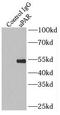 Plasminogen Activator, Urokinase Receptor antibody, FNab09268, FineTest, Immunoprecipitation image 