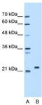 Stromal Cell Derived Factor 2 antibody, TA346863, Origene, Western Blot image 